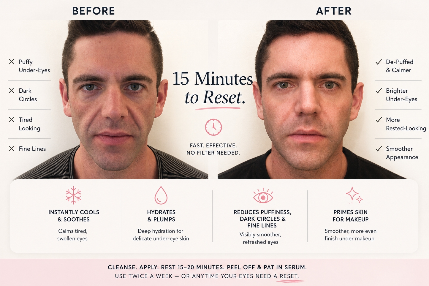 The Reset™ Hydrogel Under-Eye Patches