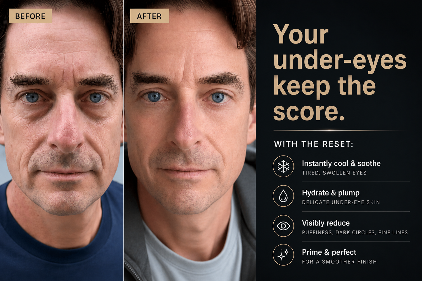 The Reset™ Hydrogel Under-Eye Patches